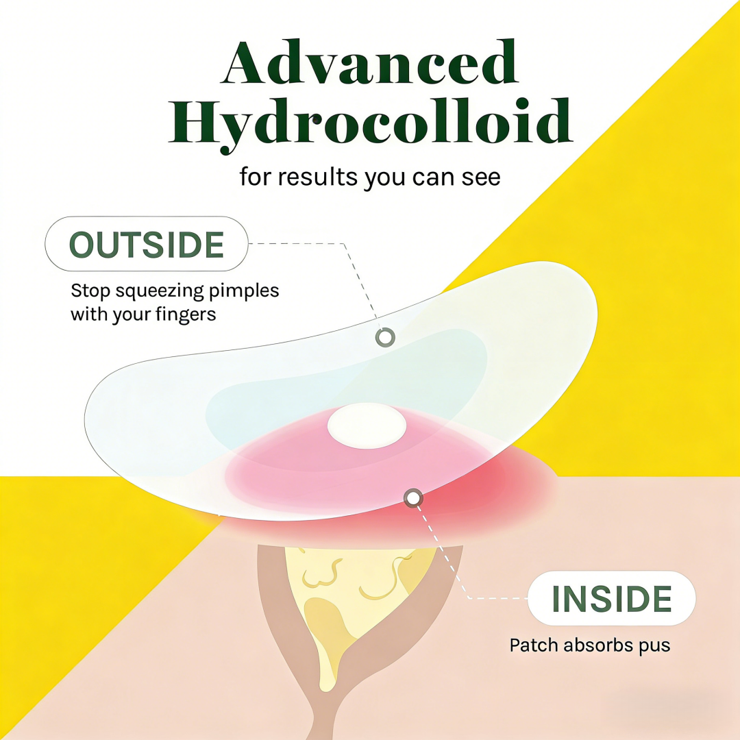 360 Pcs Round Hydrocolloid Acn - مراجعة Skincare Gentle وسعره