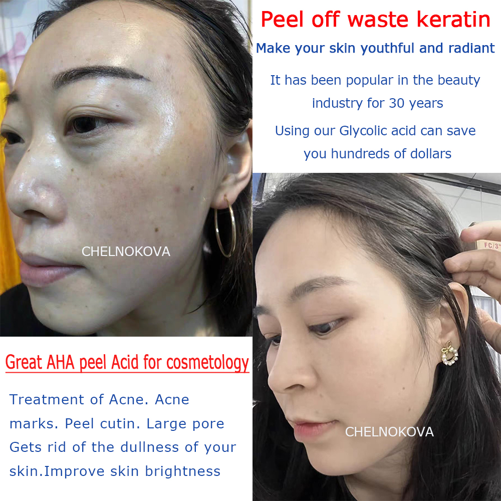 Citric acid 20% 30% 40% 50% pe - مراجعة Skincare Whitening وسعره