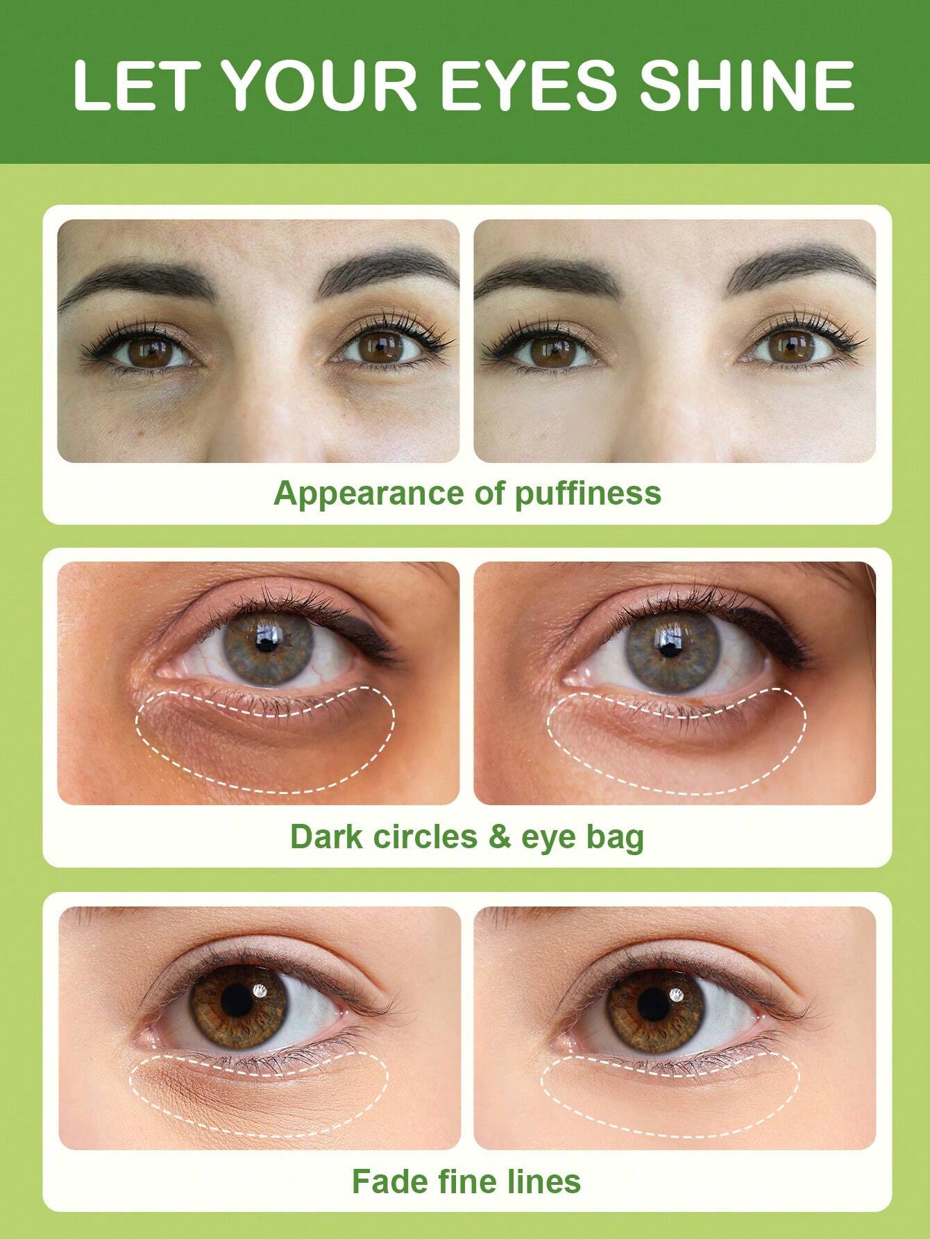 Aloe Vera Hydrating Undereye M - مراجعة Skincare Collagen وسعره