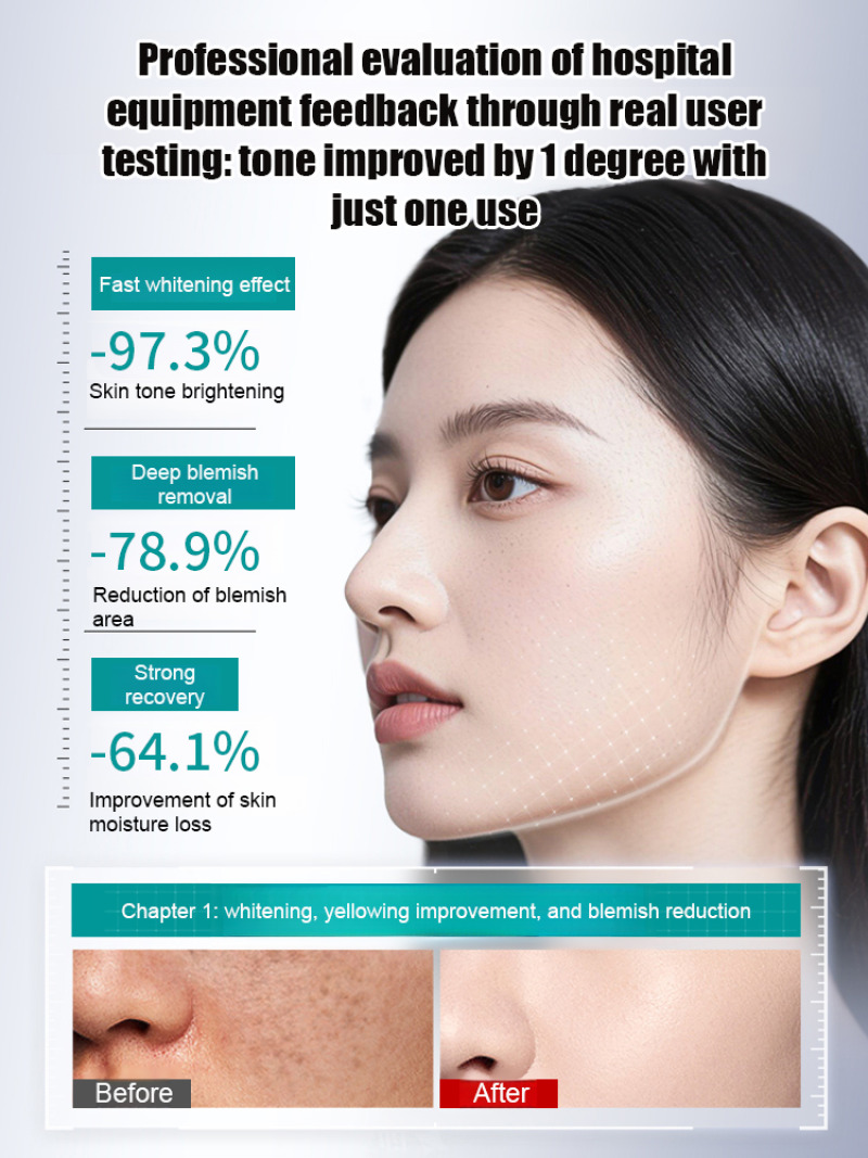 Skin Care Collagen Mask: Gentl - مراجعة Skincare Collagen وسعره