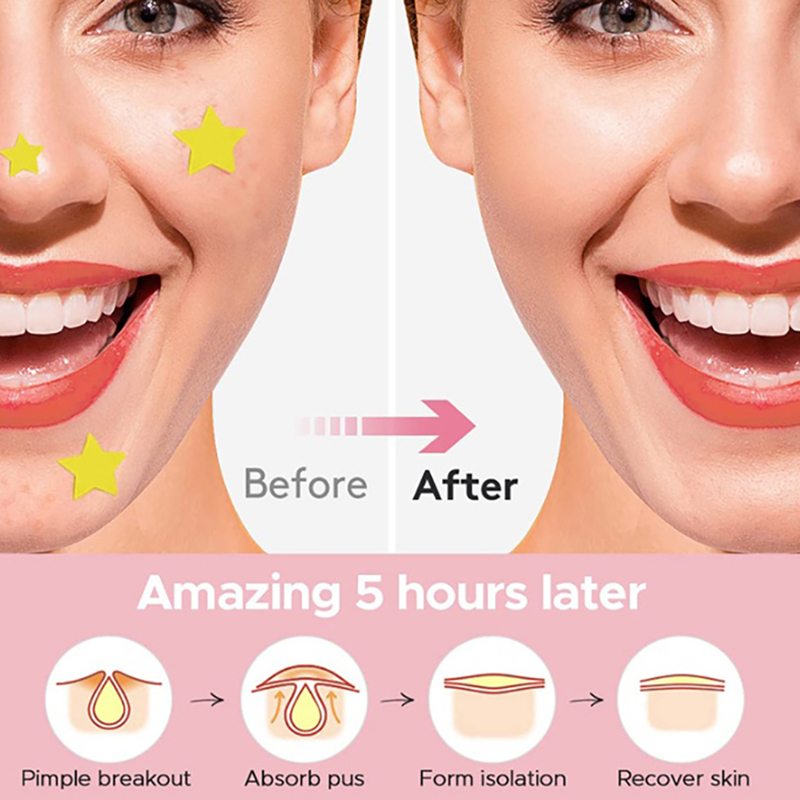 360 Pieces Of Heart Star Face  - مراجعة Skincare Whitening وسعره