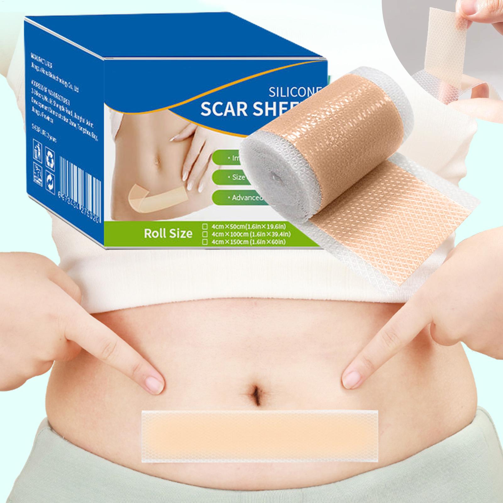 1 Roll Silicone Scar Sheets 4c - مراجعة Skincare Collagen وسعره